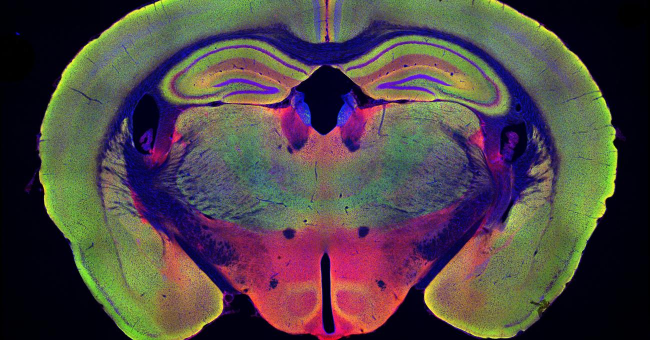 Color image of brain slice