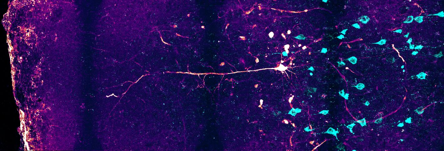 Colorful image of a neuron in a brain slice