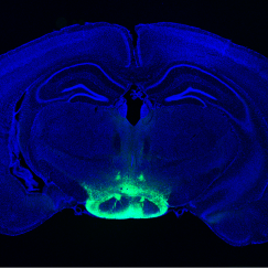 A mouse brain cross section (ear to ear) is stained in blue. At the very bottom center a squat, oval shaped structure is highlighted in a light breen hue