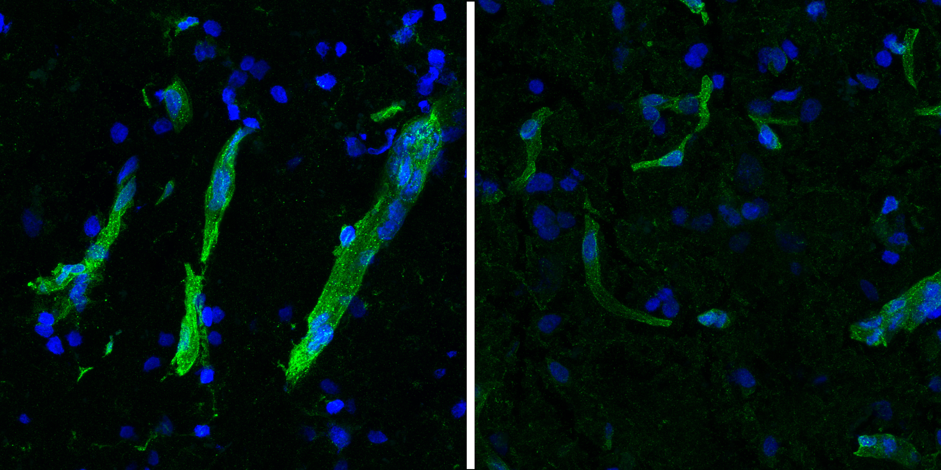 Two panels show diagonal streaks of green stained brain blood vessels over a background of blue cells. The green staining is much brighter in the left panel than in the right.