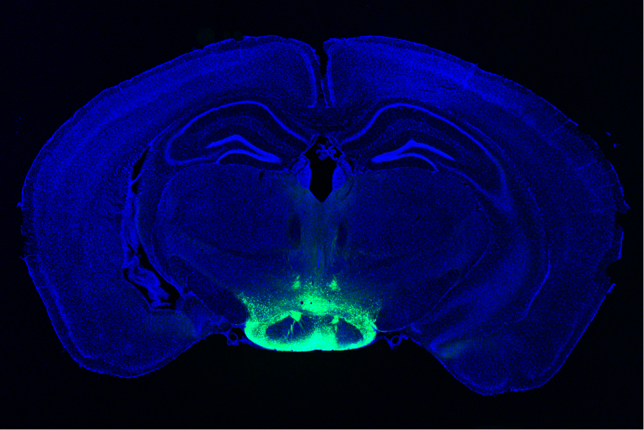 A mouse brain cross section (ear to ear) is stained in blue. At the very bottom center a squat, oval shaped structure is highlighted in a light breen hue