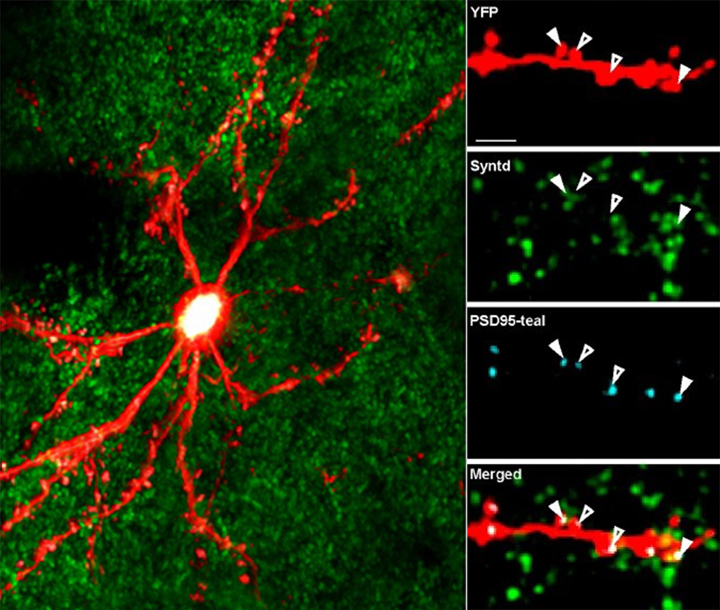 The left side shows a whole neuron stained red with little spots of green or teal. The right side shows details of one neural branch with those spots enlarged and with white arrows pointing to areas of overlap.