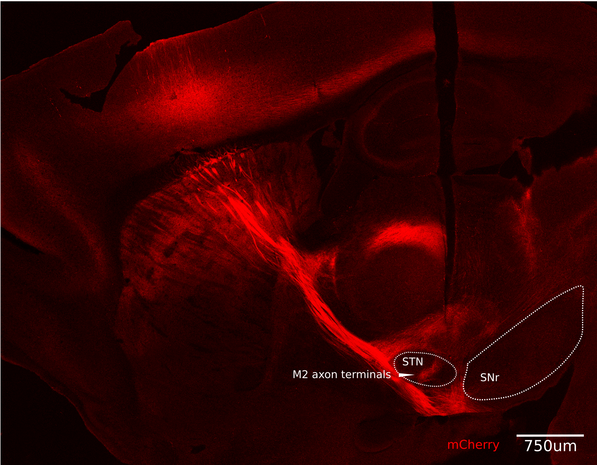 On a black background we see a large section of mouse brain highlighted in red. In particular there is a bundle of long red lines tracing from the upper left down to a region marked with white letters STN