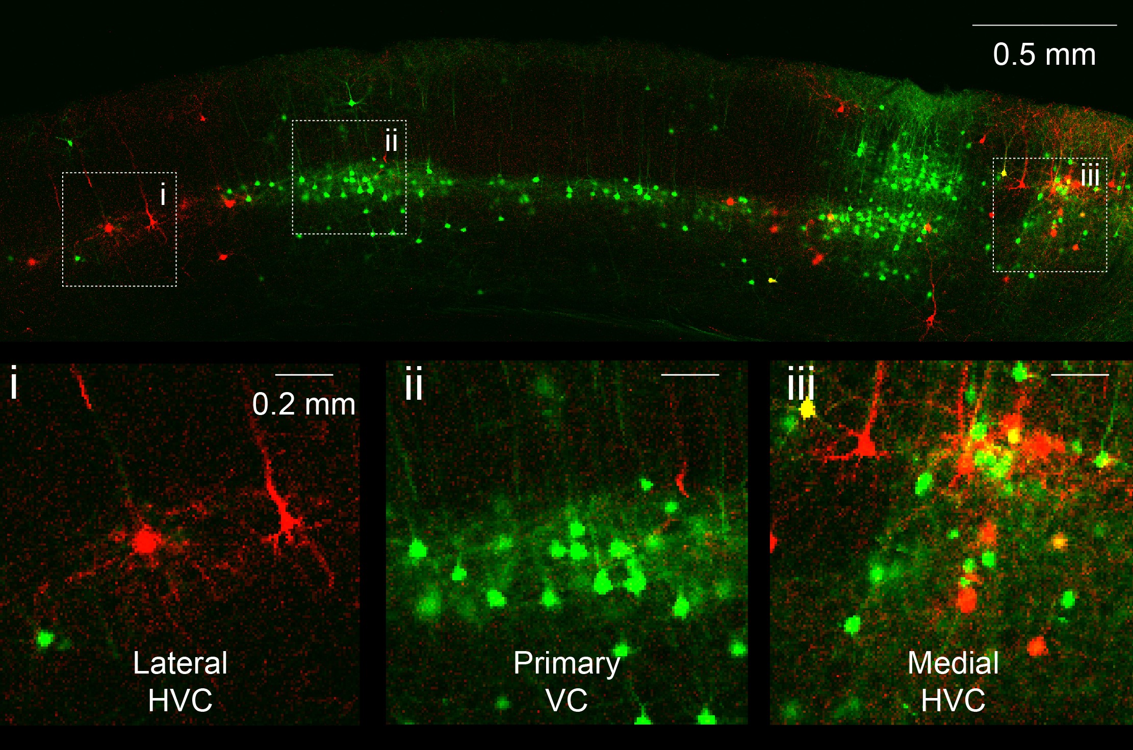 Sections of brain with green stained neurons shown at different magnifications