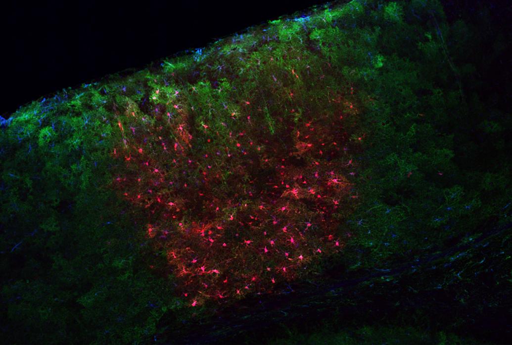 A slice of mouse visual cortex shows cells labeled in blue, red and green