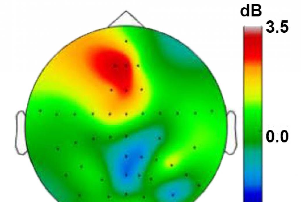 An outline of the top view of a head shows the brain filled in with colors corresponding to theta rhythm strength