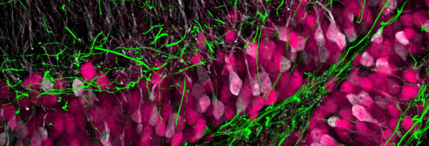 Neural tissue processed using MAP technology