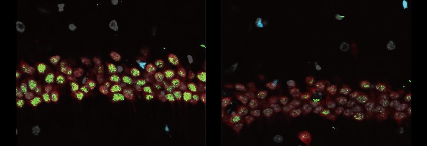 Two panels on a black background show cells on the left lit brightly in green while the cells on the right show much less green and are mostly red.