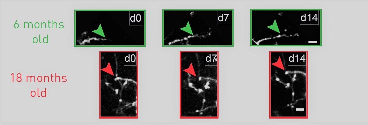 two sets of three images each show growth, or lack thereof, of dendrites beyond a marker set at day zero in 6-month and 18-month old mice