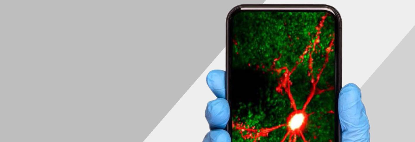 A hand wearing a blue latex glove holds up a cell phone showing the image of a red-stained neuron