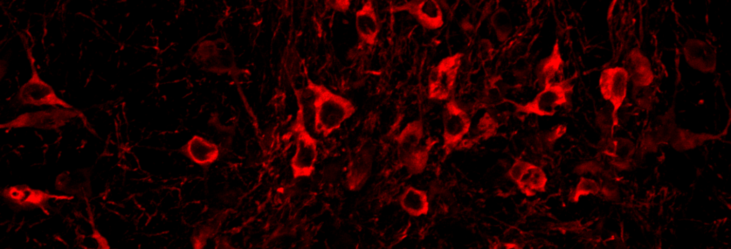 Reddish stained cells appear sprinkled over a black background