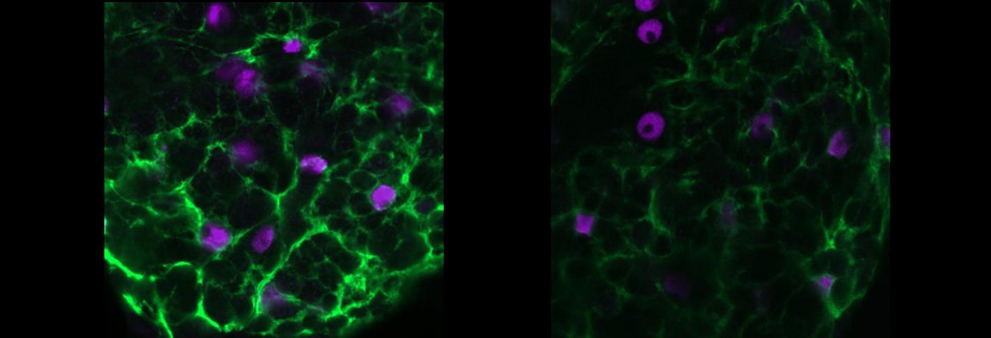 A side by side comparison shows blue cells amid wisps of light green sandman