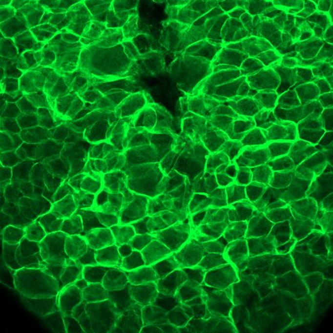 Bright green glow outlines hundreds of cells in a microscope image of tissue