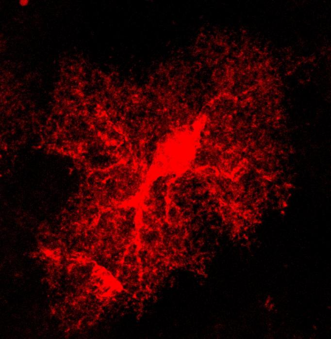 An astrocyte stained red