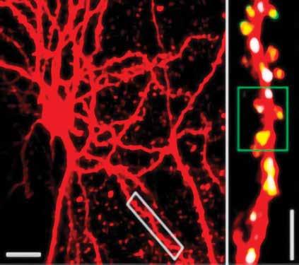 The left panel shows a red-stained neuron with many branches. On the right there is a closeup of a dendrite with lots of colorful spines.