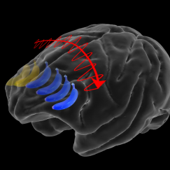 Superimposed on a semitransparent gray brain is an sequence of bananas and an arrow going from its right to left