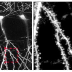 Two black and white panels show a neuron  on the left and a spiny zoomed-in section of its dendrites on the right