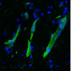 Two panels show diagonal streaks of green stained brain blood vessels over a background of blue cells. The green staining is much brighter in the left panel than in the right.