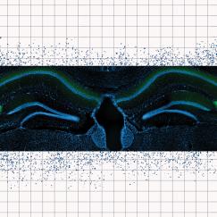 A blusih tinted image shows fluorescently labeled mouse hippocampus tissue supreposed over a sheet of graph paper with patterns of blue dots