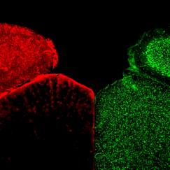 The mouse visual cortex with astrocytes stained red on the left and neurons stained green on the right.