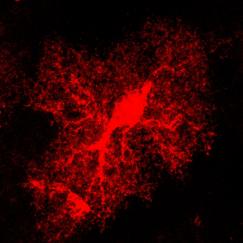 An astrocyte stained red