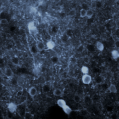 A tangle of neurons, colored ice blue, shimmer in the PPC of a mouse.