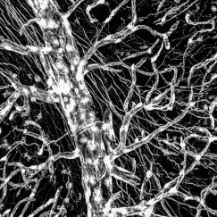 black and white blood vessel