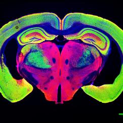 Slice through a mouse brain shows huge ventricles opened up by neurodegeneration in a p25 mouse