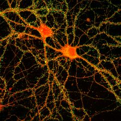 Two neurons next to one another (red)