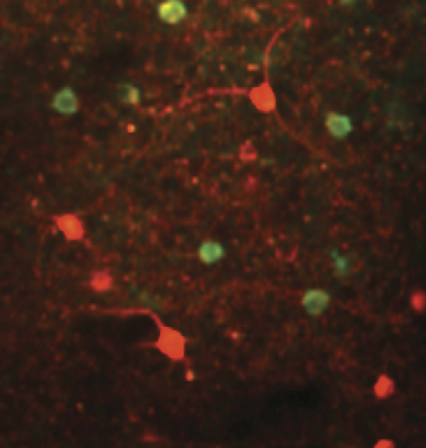 On a dark background red and green neurons glow