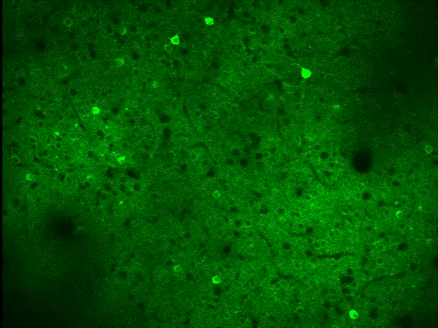 Neurons stained green blink on and off sproradically amid darrker colored tissue