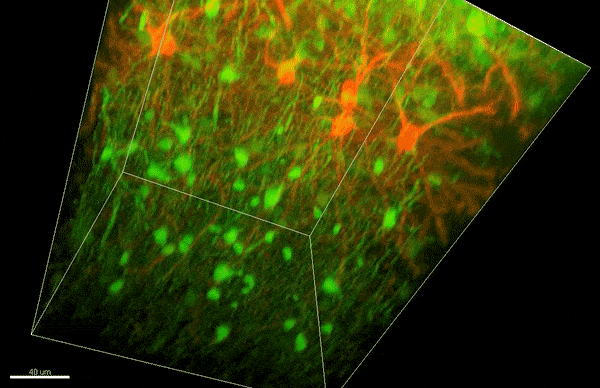 A video showing a 3D block of red and green neurons with myelin