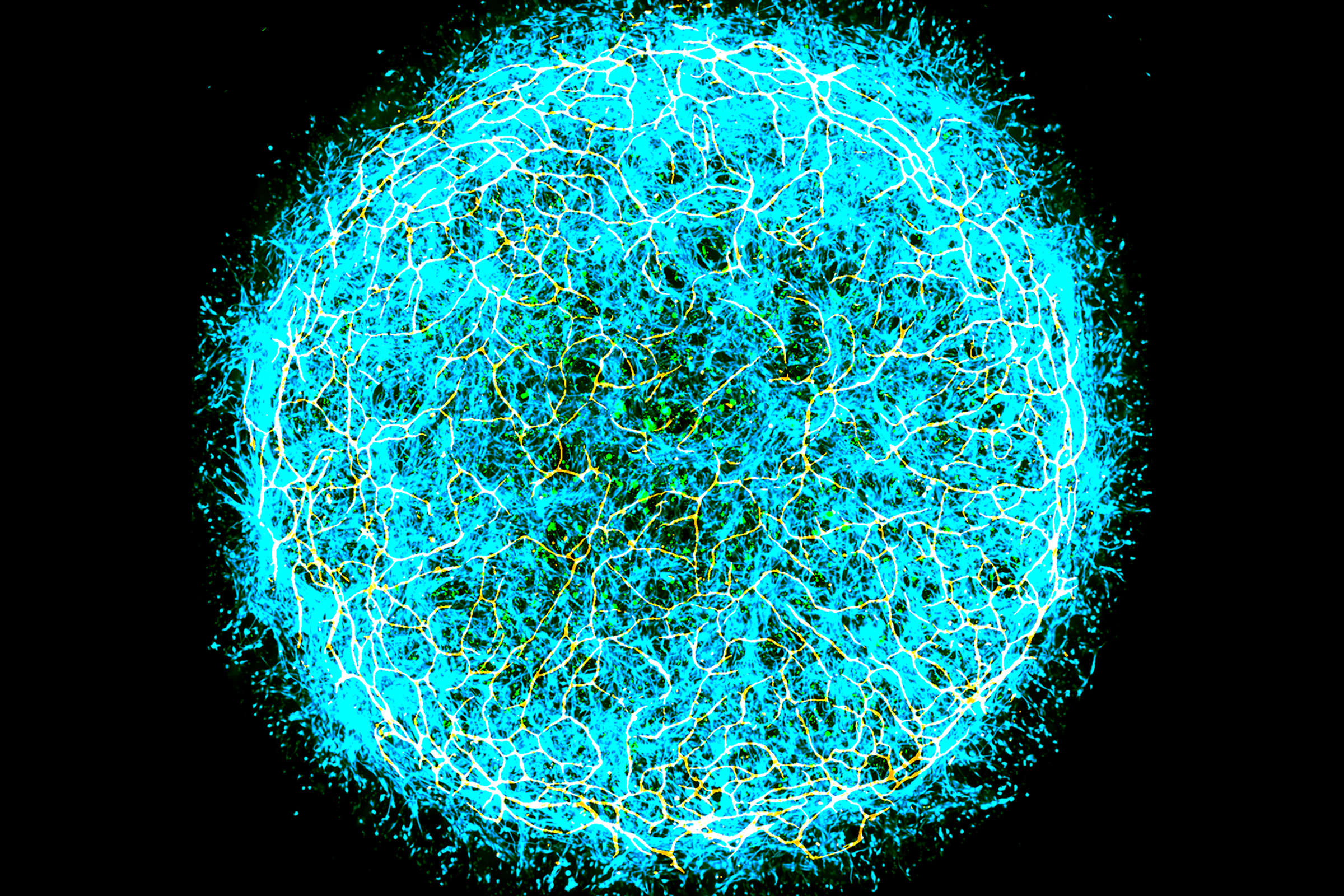 A miBrain stained in different colors looks like a tight tangle of many cells in a thick disk
