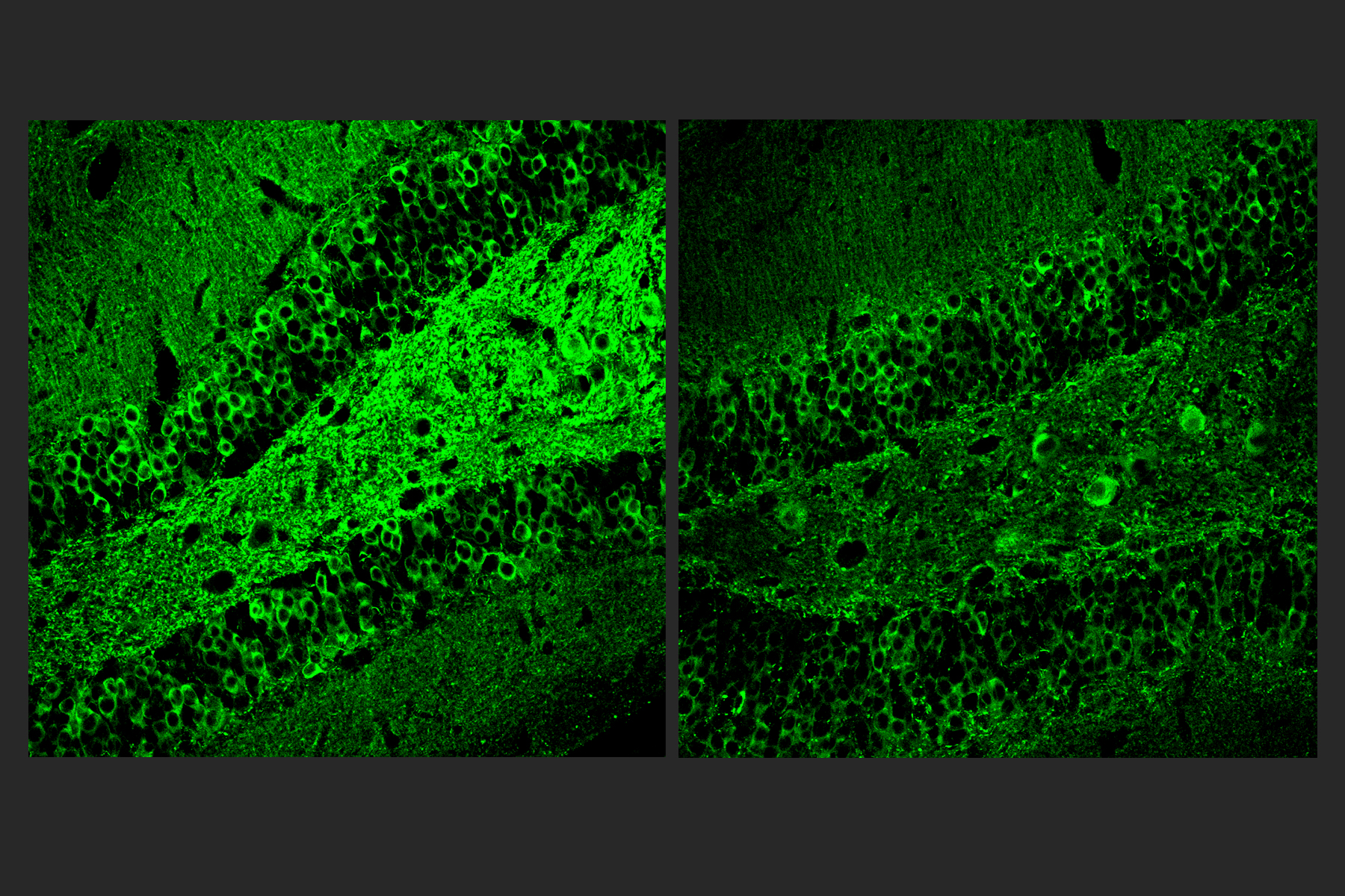 Two square panels side by side show brain tissue with green staining. The panel on the left shows much more green than the panel on the right.