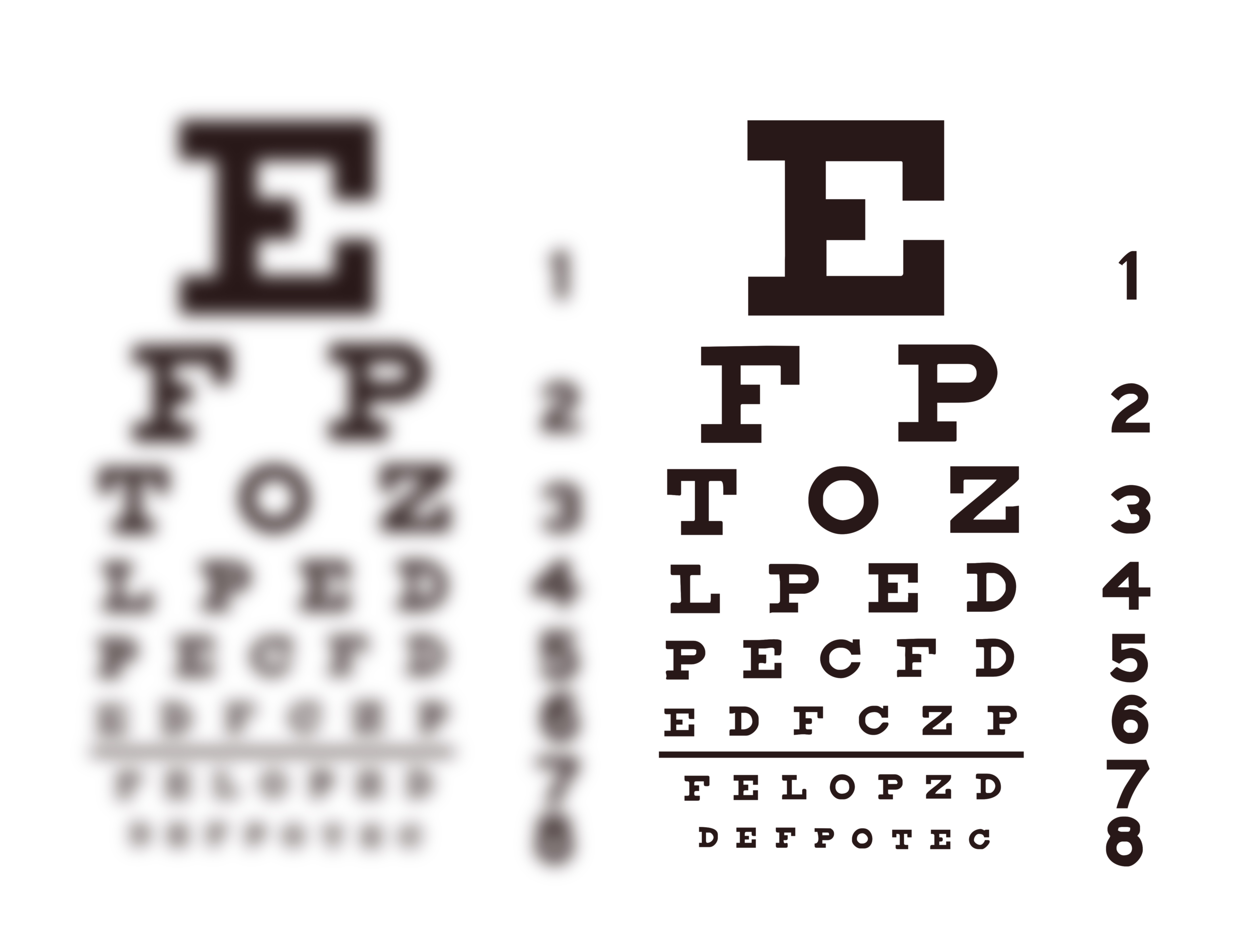 Two eye charts used for testing vision are side by side. One is blurry while the other is crisp.