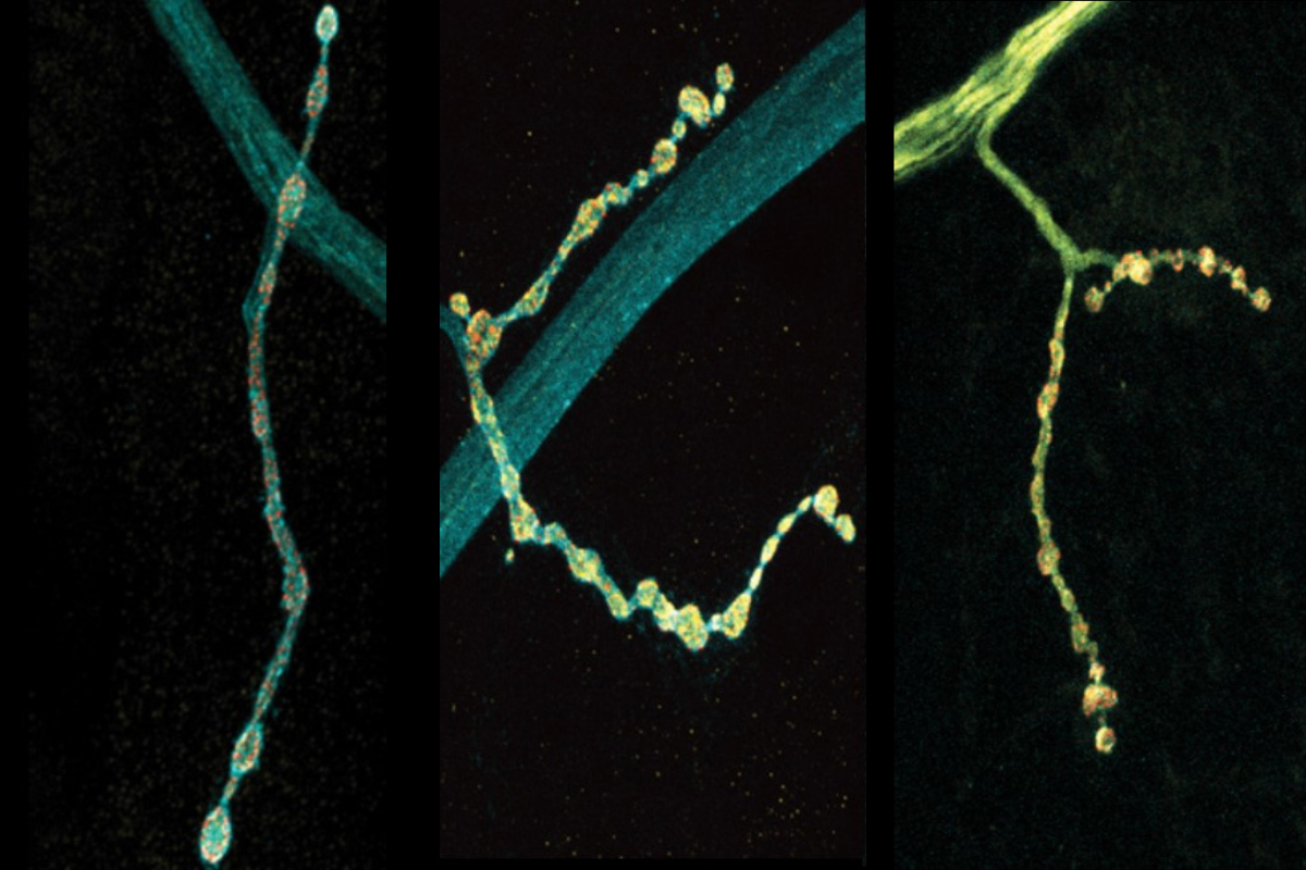 On a black background three panels show a branch of a neuron where there is a thick main part and a thinner protrusion lined with little bulbs. The leftmost panel shows a gray main part with a somewhat yellow protrusion. The middle shows a grey thin part with a very yellow protrusion. In the right panel everything is very yellow.