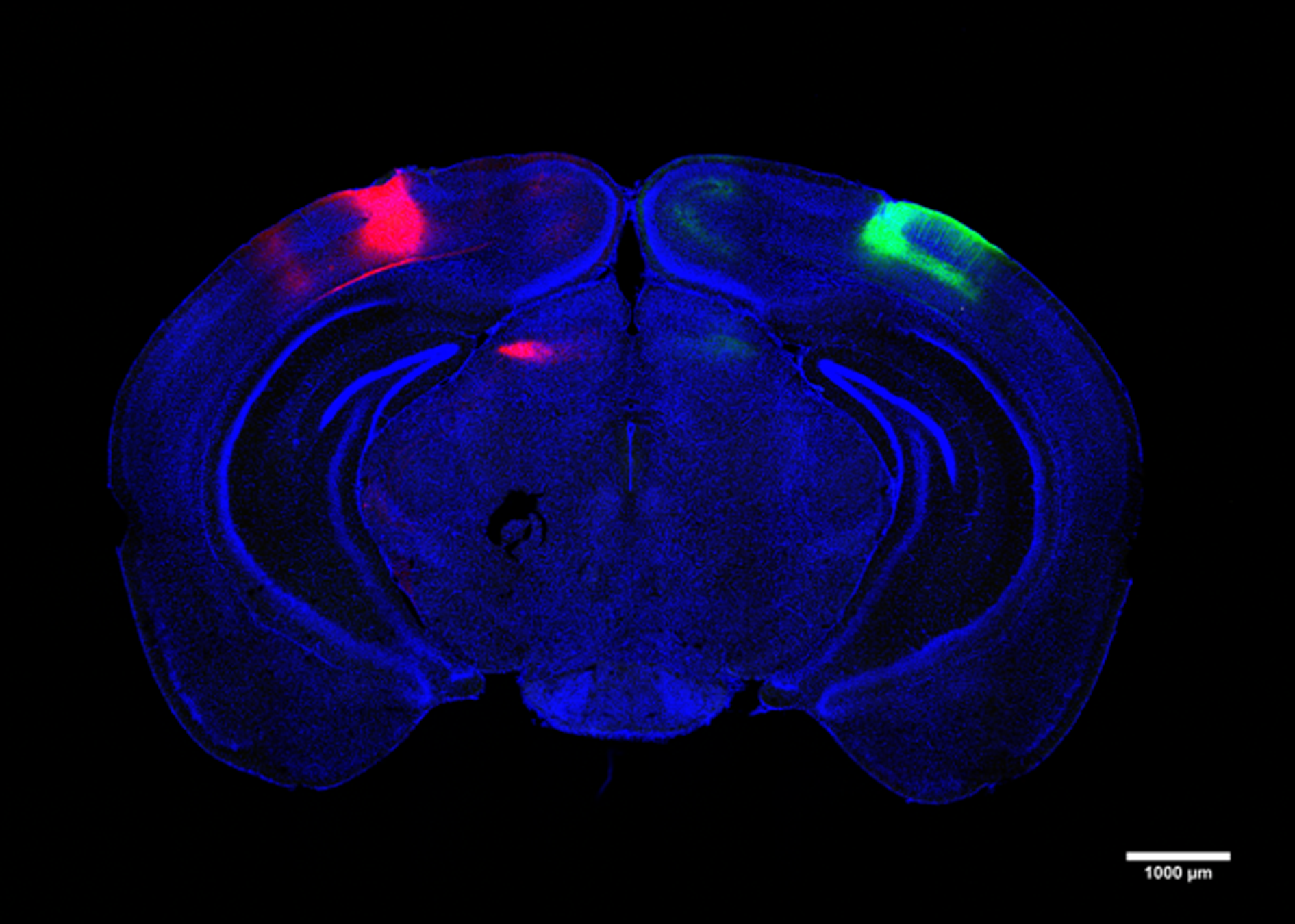 A coronal (ear to ear) cross-section of a mouse brain on a black backround shows the entire brain in blue except a red area on the top left and a green area on the top right
