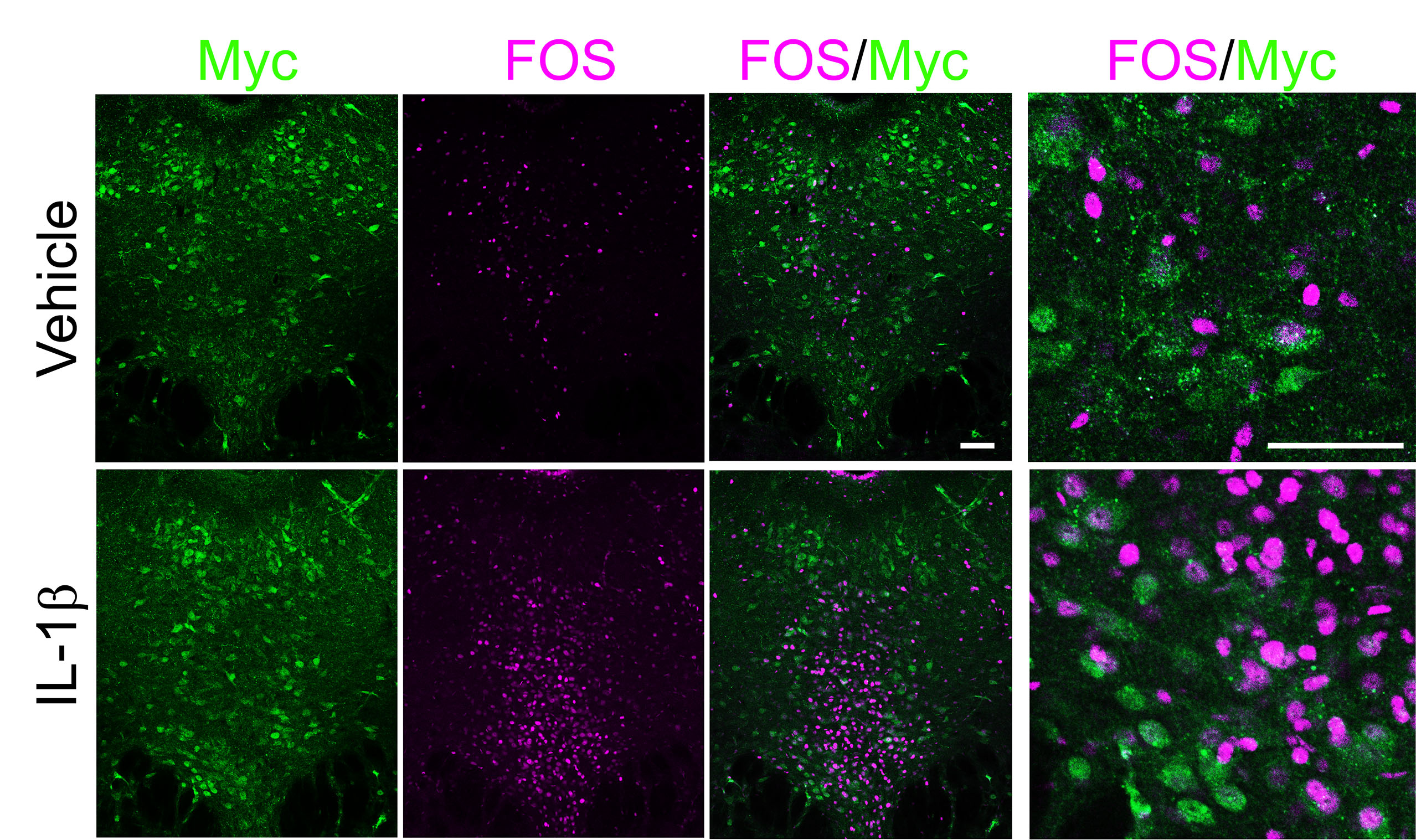 A 4 by 2 array of panels shows neurons in a brain section. Green "Myc" labeling indicates the presence of a receptor. Magenta "fos" labeling indicates neural activity. There is more magenta on the bottom row, which is labeled "IL-1B"