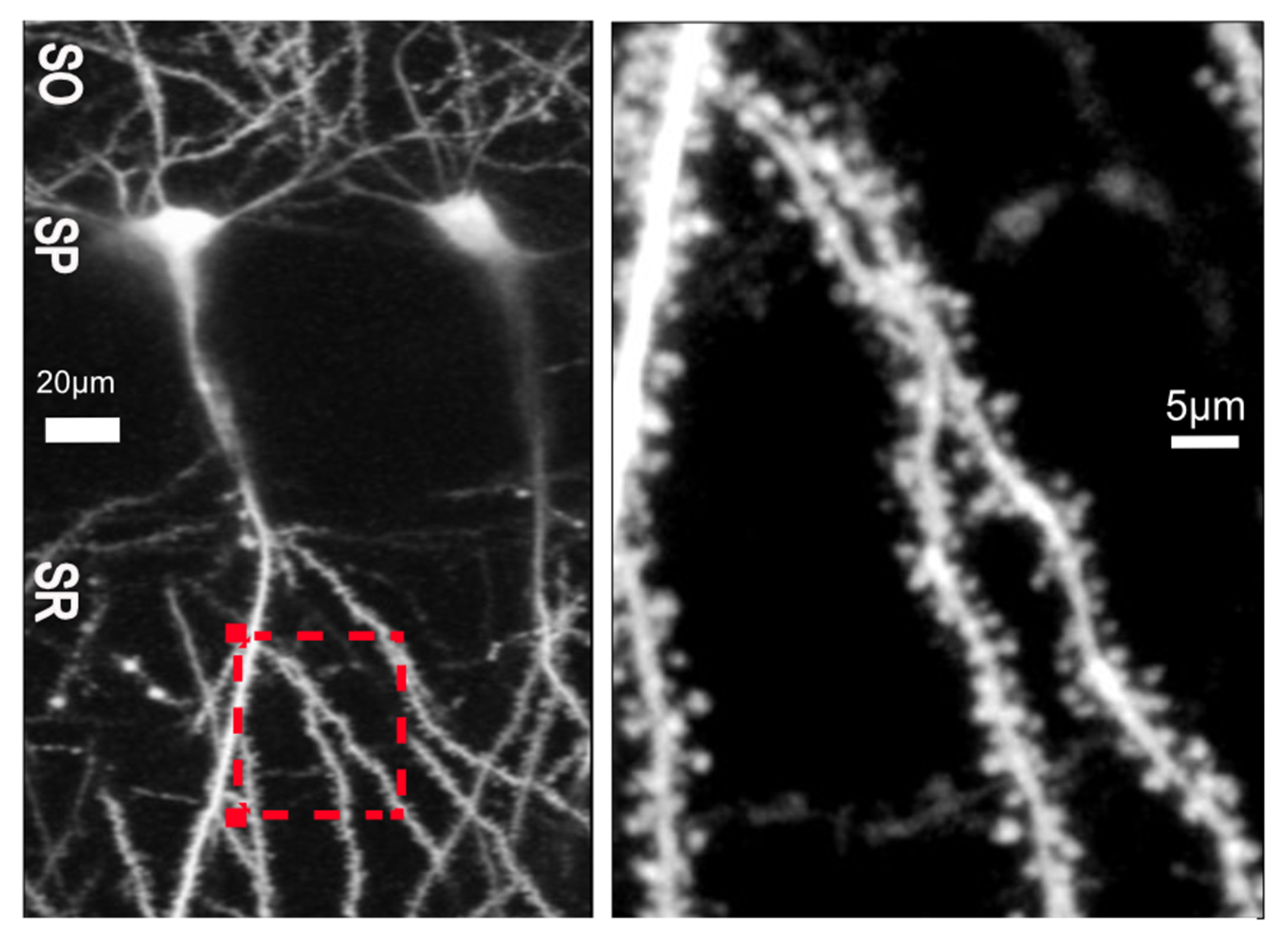 Two black and white panels show a neuron  on the left and a spiny zoomed-in section of its dendrites on the right
