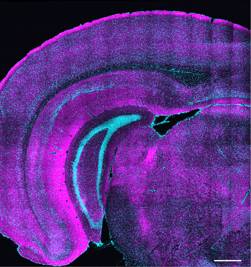 A cross section of a mouse brain glows with a magenta hue. Many individual speckles across the whole brain are lit up brighter.