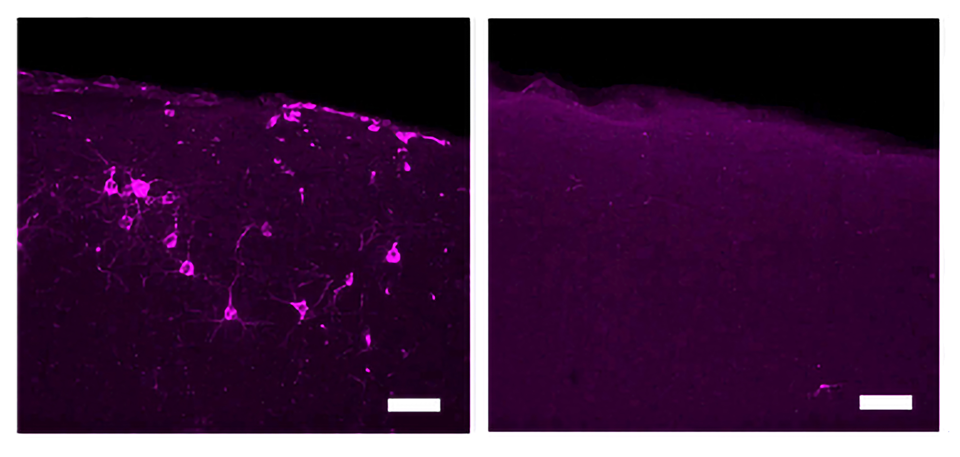 Two panels show cells with magenta staining on the left and a broader field of magenta with now specific cells visible on the right