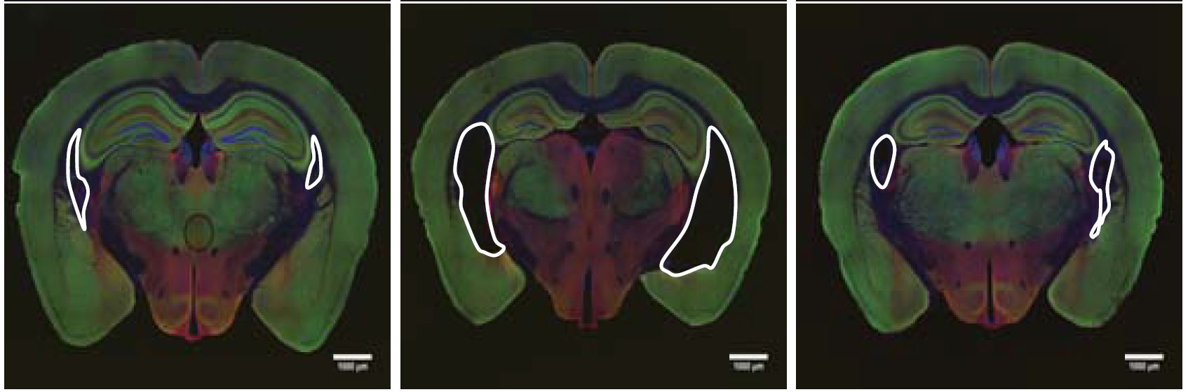 Three mouse brains in a row. White outlines show ventricles, or dark open spaces within