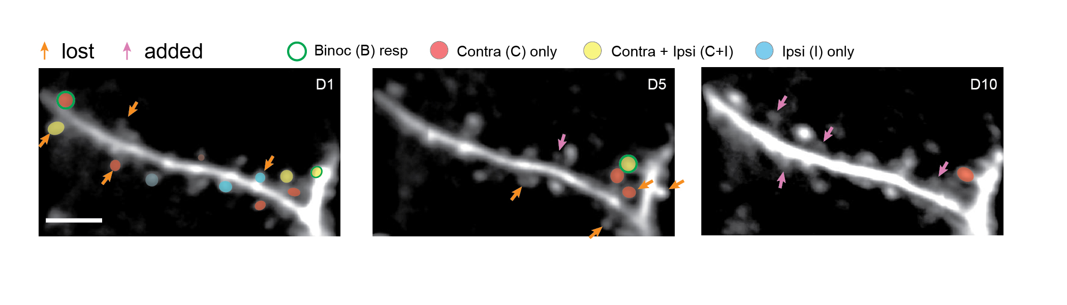 Three panels in a horizontal row show the same neural dendrite with subtle changes in the tiny spines protruding from the dendrite. Arrows indicate which spines will be added or lost between days 1, 5 and 10 of imaging