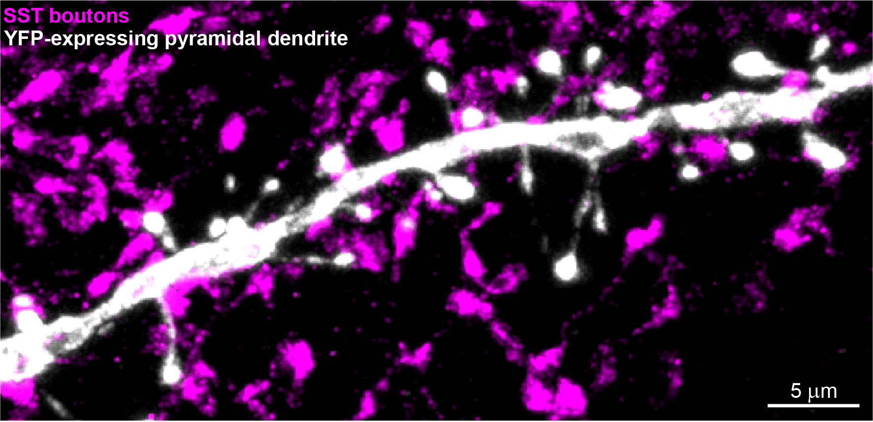 A closeup of a long section of a neural dendrite shows the dendrite in white with its many protruding spines like a grape vine. The black background is speckled with many oval magenta shapes that represent SST boutons.