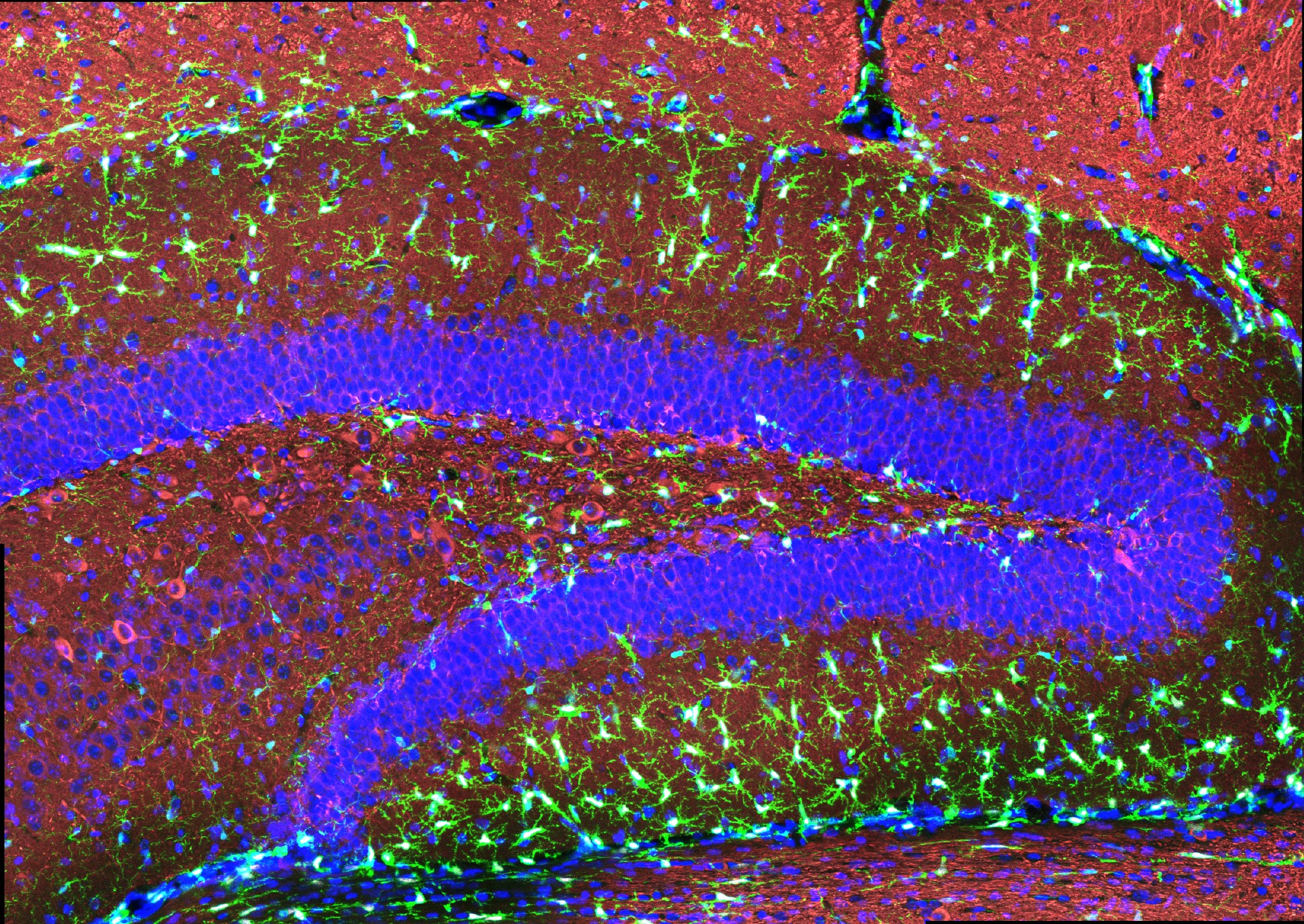 A colorfully stained section of a mouse hippocampus features scores of brightly glowing spiny-looking cells scattered throghout layers of tissue stained in blue and red