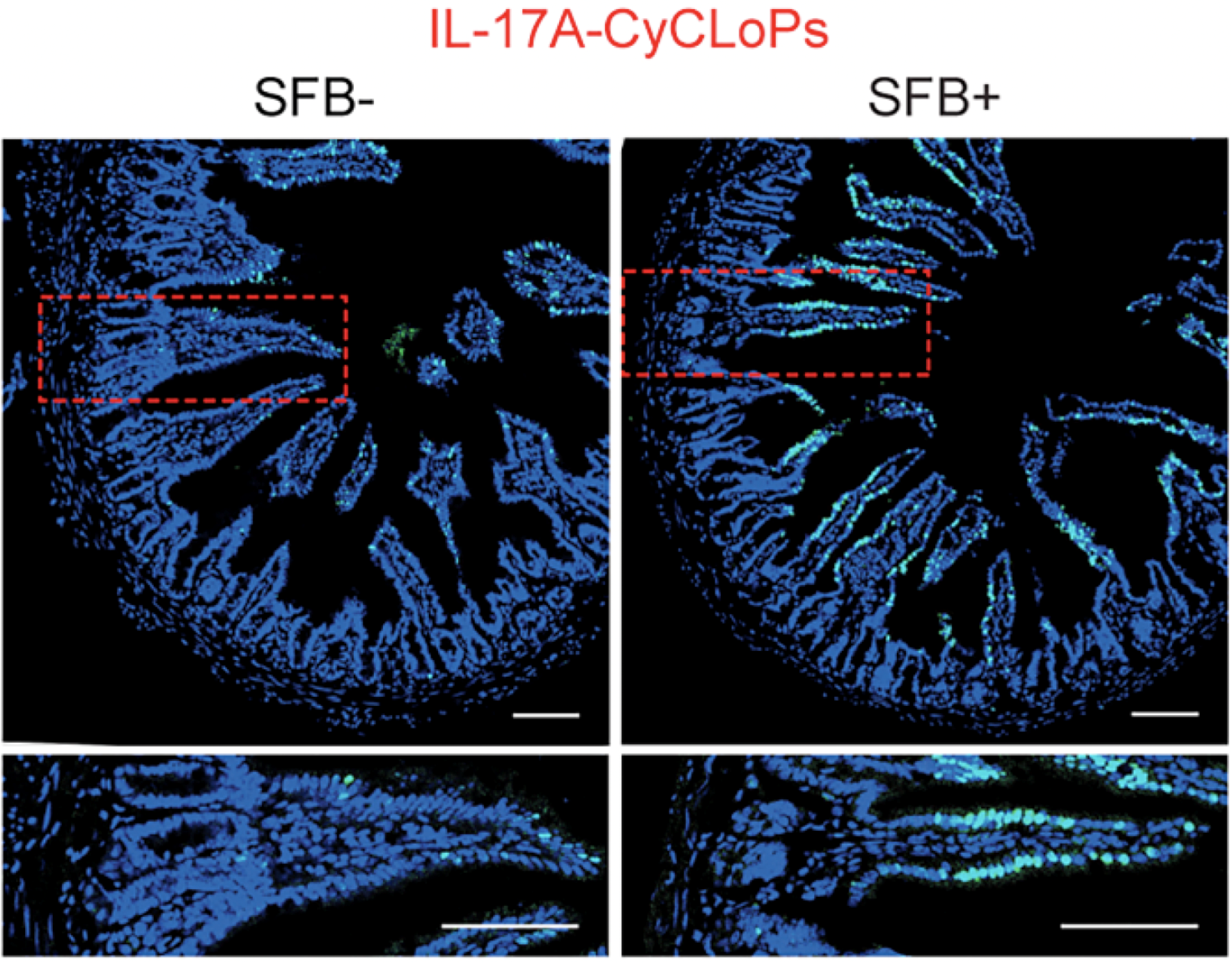 Four panels in a 2x2 array show a segment of intestine cross-sectioned in a deep blue. The left side shows when there is no bacteria and no cytokine response. On the right side there is bacteria and some of the tissue glows white. The bottom row of panels shows those areas zoomed in.