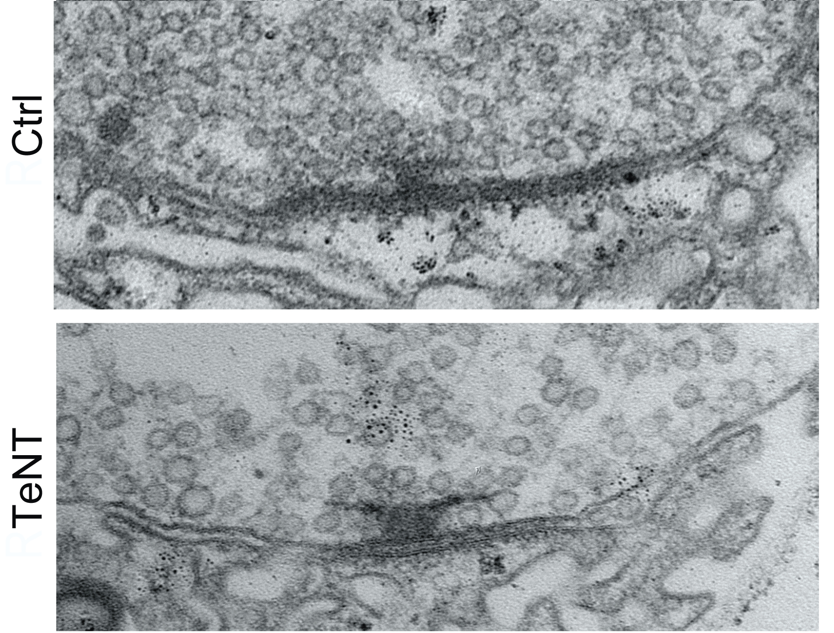 Two stacked electron microscope images show a synapse. Above a small, river-like gap is a dark T shape among many tiny bubble-like circles. In the bottom image the T shape is much bigger than in the upper image.