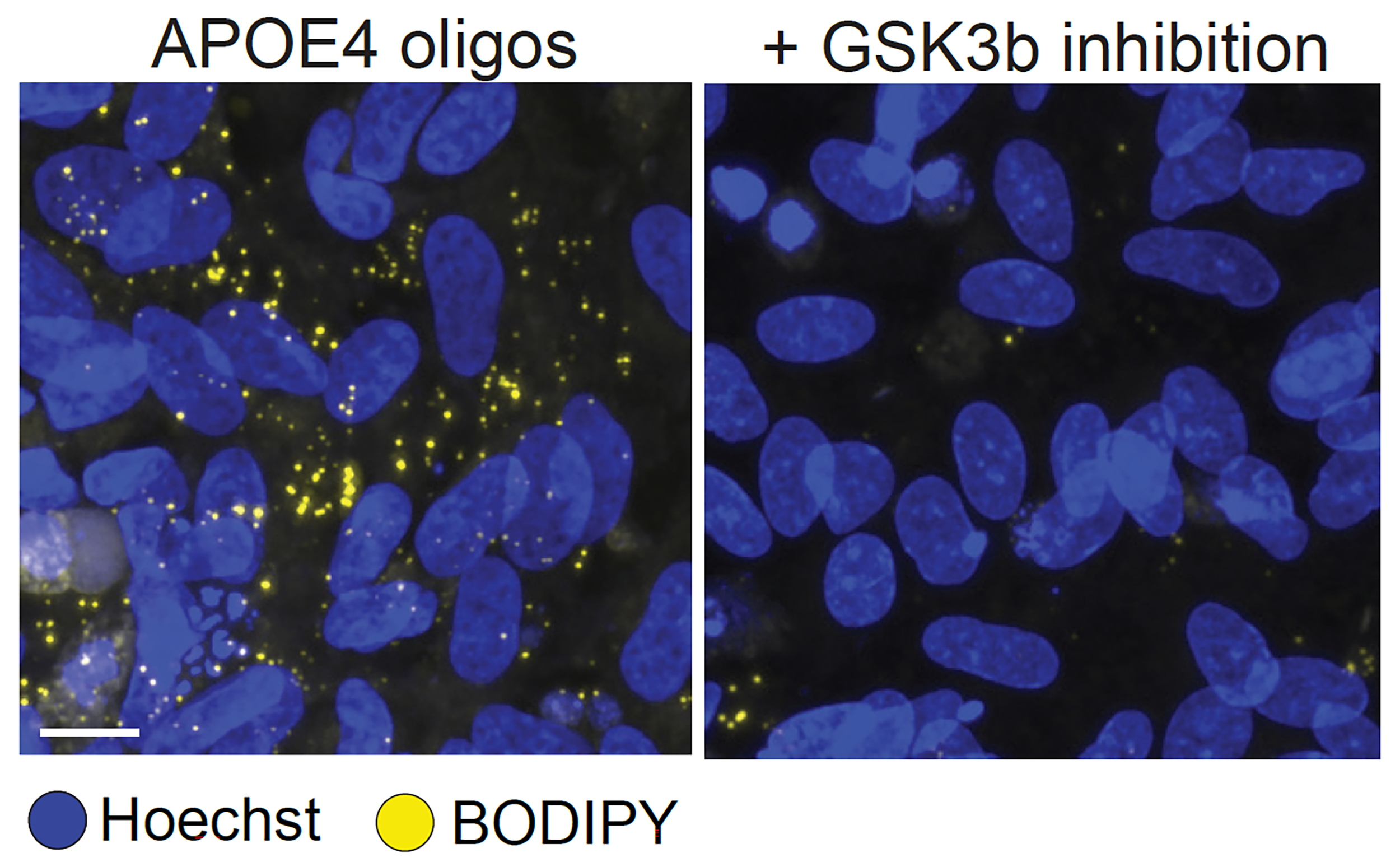 Two panels show blue cell nuclei. On the left, under the heading "APOE4 oligos" there are a lot more of the yellow speckles than on the right under the heading "+Gsk3b inhibition"