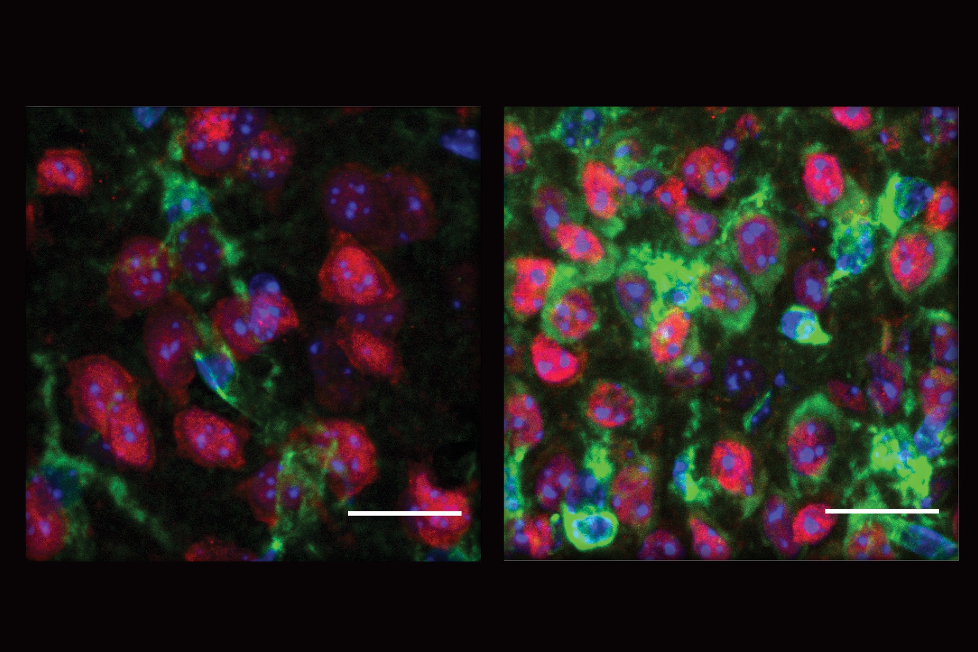 Two side by side panels compare neurons stained in red blue and green