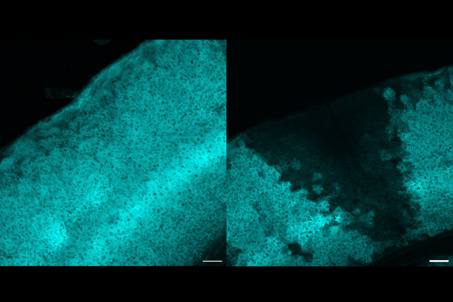 Two square images side by side show arcs of thousands of densely-packed brain cells stained in cyan. On the left the arc is uninterrupted but on the right the arc features a dark wedge of no cyan staining.